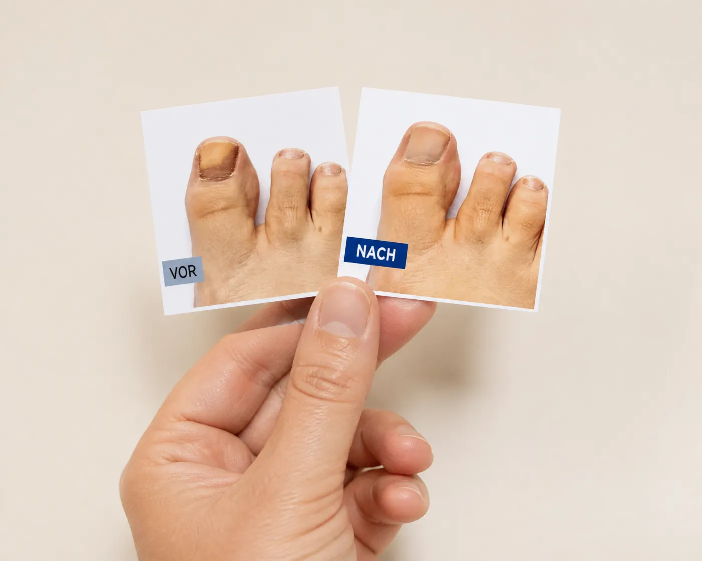 EXODERMIN EU — Verpackung in der Hand